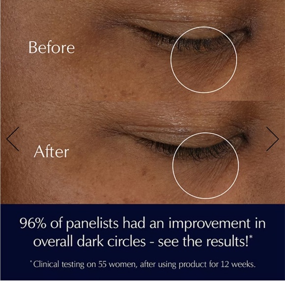 ESTEE LAUDER Advanced Night Repair Eye cream - Picture 4 of 6